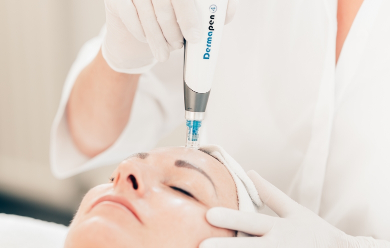 Gesichtsbehandlung mit hautverjüngendem Dermapen